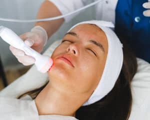Radiofrecuencia Rostro-opt
